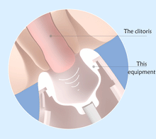 Load image into Gallery viewer, Nipple Clits Sucker 7 Modes Clitoral Sucking Vibrator